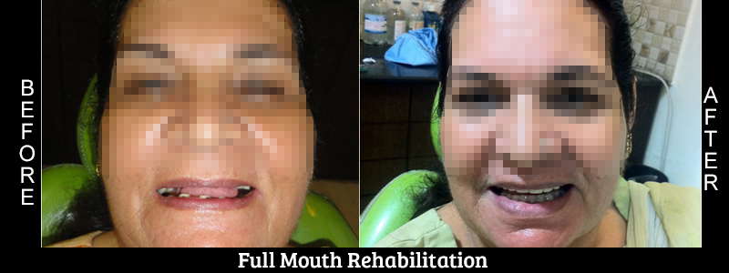 Before Cosmetic Treatment