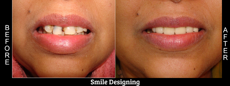 Before Cosmetic Treatment