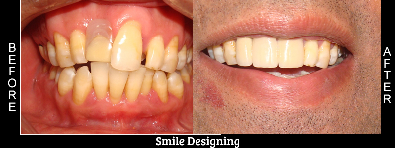 Before Cosmetic Treatment
