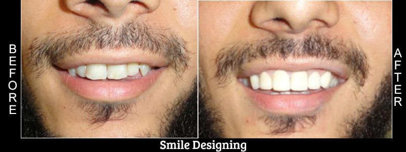 Before Cosmetic Treatment