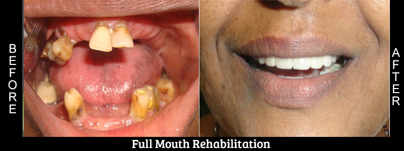 Before Cosmetic Treatment