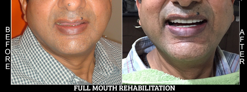 Before Cosmetic Treatment