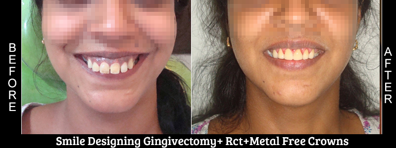 Before Cosmetic Treatment