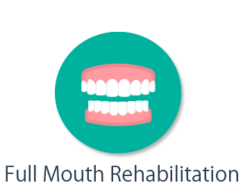 Full Mouth Rehabilitation