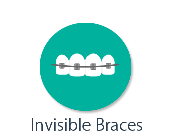 Invisible Braces