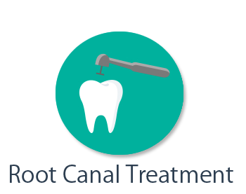 Root Canal Treatment